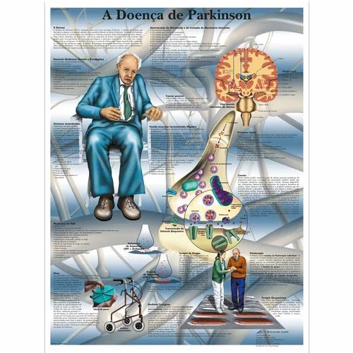 A Doença de Parkinson – 1002189