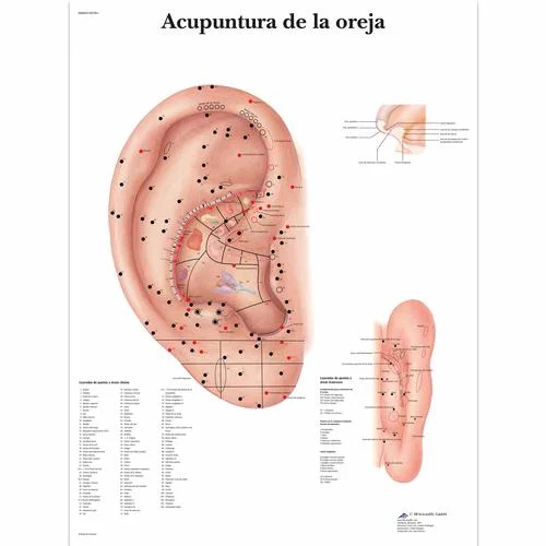 Acupuntura de la oreja – 4006895