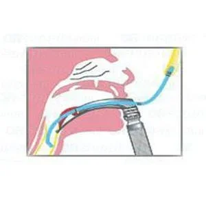 Adult Blue Line Tracheal Tube Introducer 15 fr