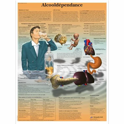 Alcoolodependance – 1001789