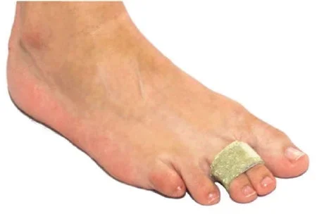 Alimed Toe FX Toe Splint One Size Fits Most Hook and Loop Closure Toe – 66410