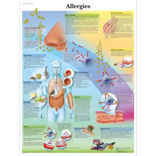 Allergies Chart – 1001596