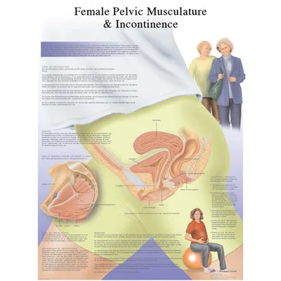 Anatomical Chart – female urinary incontinence chart, paper – 12-4632P
