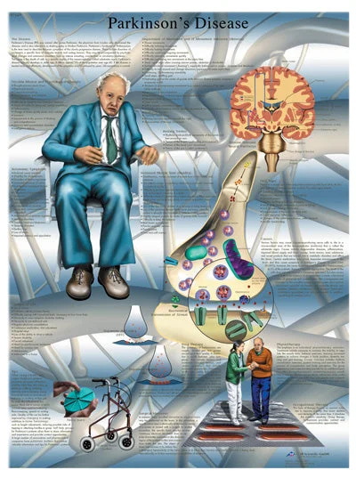 Anatomical Chart – Parkinson’s disease, laminated – 12-4616L