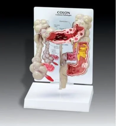 Anatomical Chart Company Colon Model – G334
