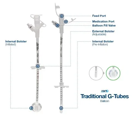 Applied Medical Technologies AMT Gastrostomy Tube 14 Fr. Adjustable up to 10cm Silicone – 7-1410