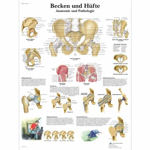 Becken und Hüfte – Anatomie und Pathologie – 1001320