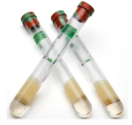Becton Dickinson BD Vacutainer CPT Molecular Diagnostic Tube Cell Preparation Sodium Heparin / Separator Gel Additive 16 X 125 mm 8 mL Green / Red Mottled Conventional Closure Glass Tube – 362753