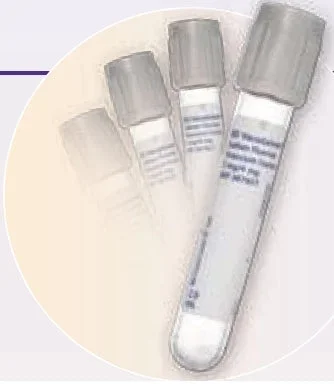 Becton Dickinson BD Vacutainer Venous Blood Collection Tube Glucose Determination Sodium Fluoride / Potassium Oxalate Additive 16 X 100 mm 10 mL Gray Conventional Closure Glass Tube – 367001