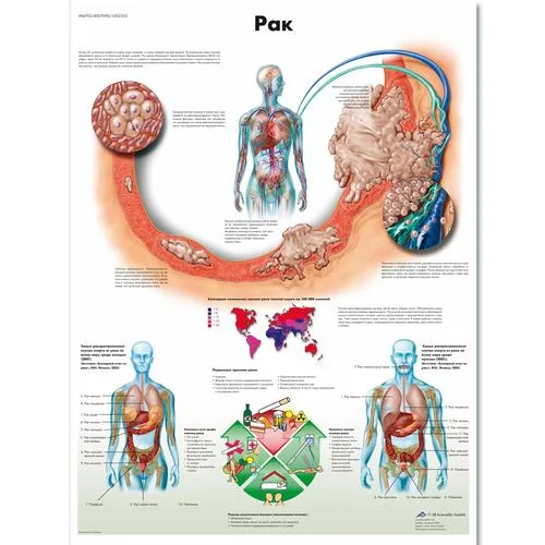 Cancer Chart – 1002353