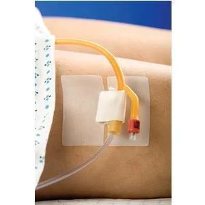 CATH-SECURE Multi-Purpose Tube Holder 2-1/2″ Tab & 3″ x 1-3/4″ Base