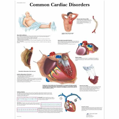 Common Cardiac Disorders Chart – 4006680