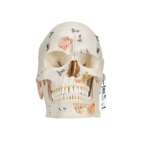 Deluxe Human Demonstration Dental Skull Model, 10 part – 3B Smart Anatomy – 1000059