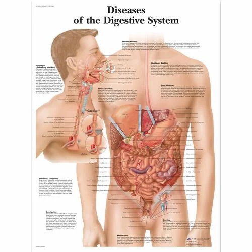 Diseases of the Digestive System Chart – 4006691