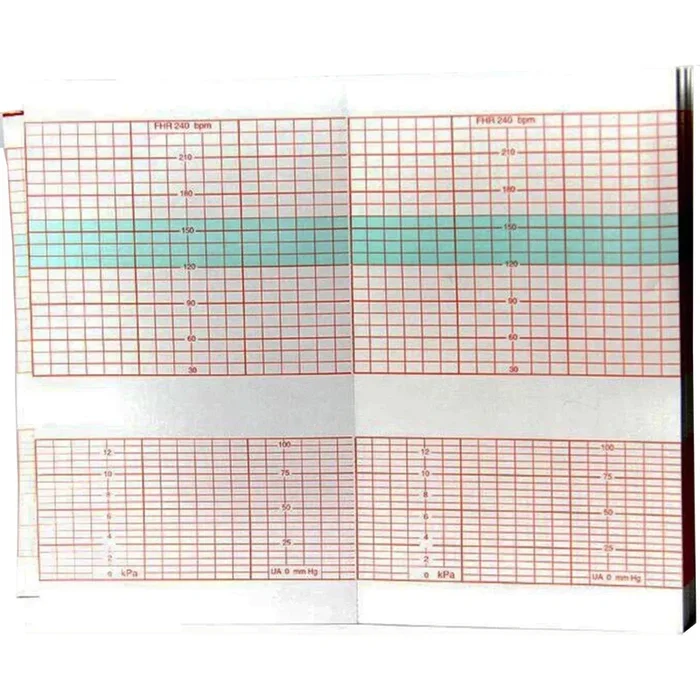 Edan Fetal Diagnostic Monitor Recording Paper