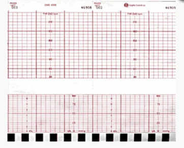 GE Corometrics Fetal Chart Paper 40/cs
