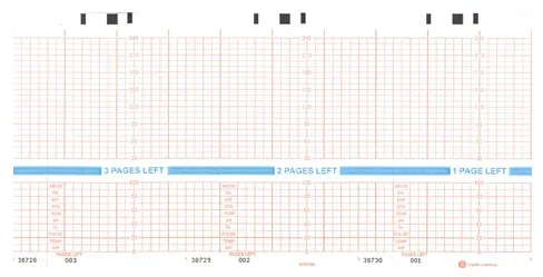 Graphic Controls Industrial Hewlett Packard Fetal Monitor Recording Paper 150 mm X 49 Foot Fan-Fold Orange Grid – 7G30748696