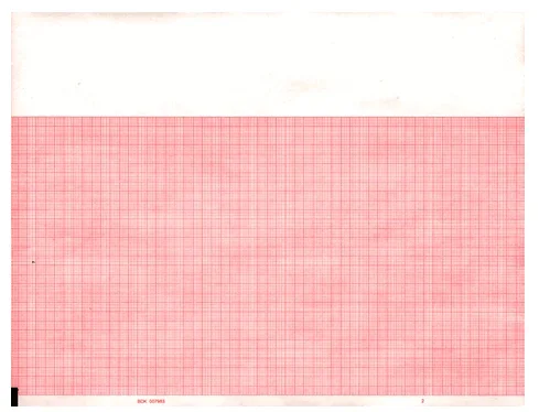 Graphic Controls Industrial Kendall ECG Recording Paper Thermal 8.47 Inch X 183 Foot Pad Red Grid – 31334595