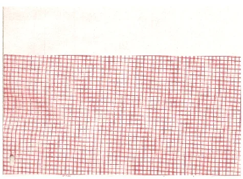 Graphic Controls Industrial Kendall ECG Recording Paper Thermal 8.49 Inch X 183 Foot Fan-Fold Red Grid – 30768678
