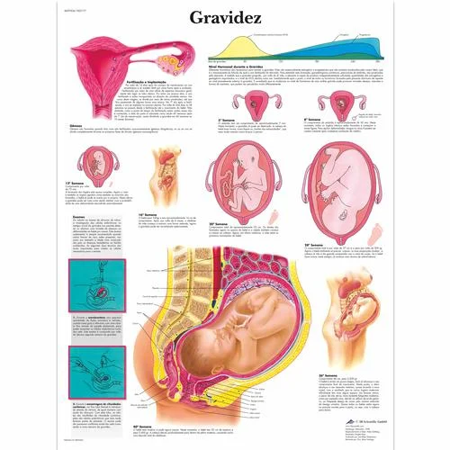 Gravidez, 50×67 cm, Laminado – 1002177