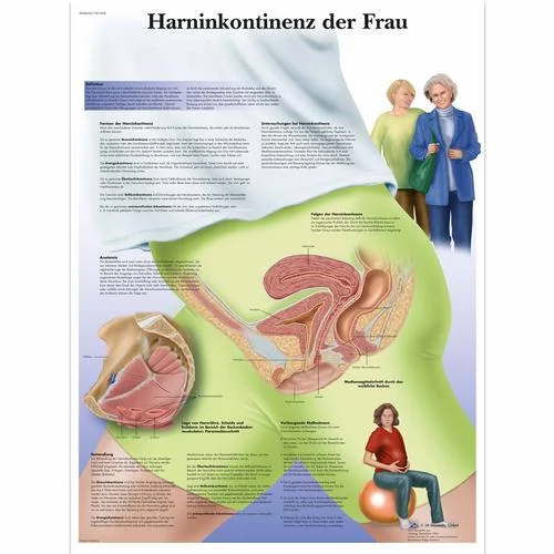 Harninkontinenz der Frau – 1001406