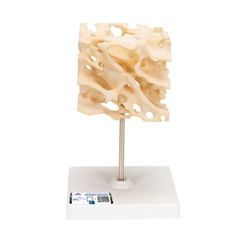 Human Cancellous Bone Model, Enlarged 100 times – 3B Smart Anatomy – 1009698