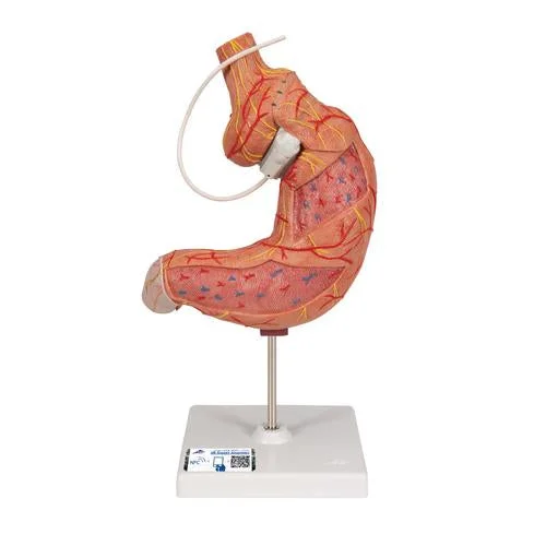 Human Stomach Model with Gastric Band, 2 part – 3B Smart Anatomy – 1012787