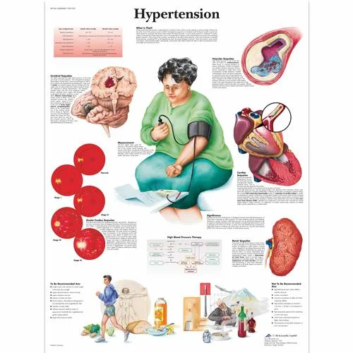 Hypertension Chart – 1001532