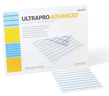 J & J Healthcare Systems ULTRAPRO ADVANCED Hernia Repair Mesh Partially Absorbable Polypropylene / Poliglecaprone-25 15 cm x 15 cm Square Style – UPA31515