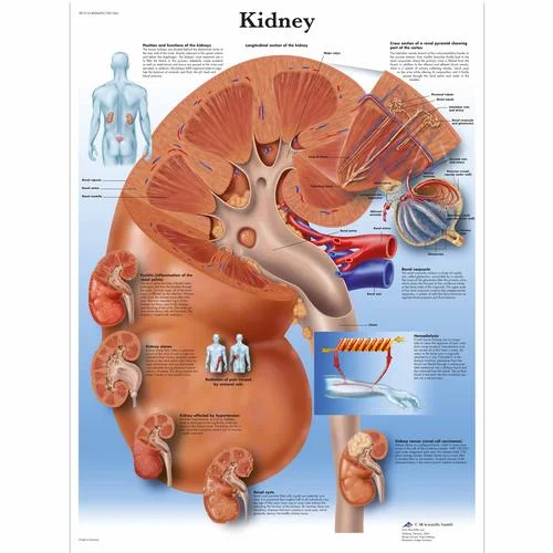 Kidney Chart – 1001564