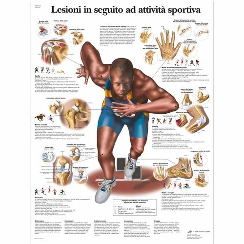 Lesioni in seguito ad attivitá sportiva – 1001991