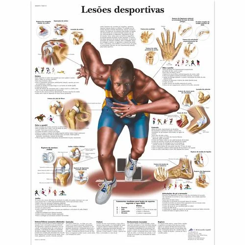 Lesoes esportivas, 50×67 cm, Laminado – 1002151