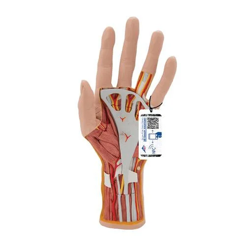 Life-Size Hand Model with Muscles, Tendons, Ligaments, Nerves & Arteries, 3 part – 3B Smart Anatomy – 1000349