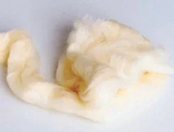 McKesson Lamb’s Wool