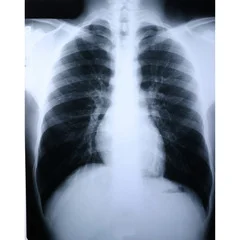 McKesson X-Ray Film Clear Choice™ Performance 10 X 12 Inch Medium Speed Green Sensitive High