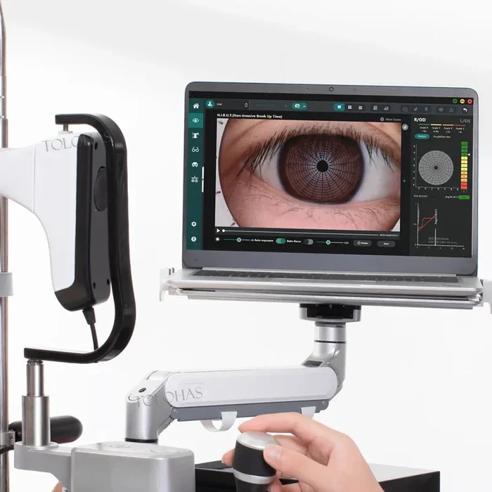 Medical Dry Eye Analyzer Machine I Ophthalmic Examination Integrated Dry Eye Test Device