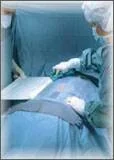 Microtek Medical Surgical Drape Probe Drape 5 W X 96 L Inch Sterile – 3787