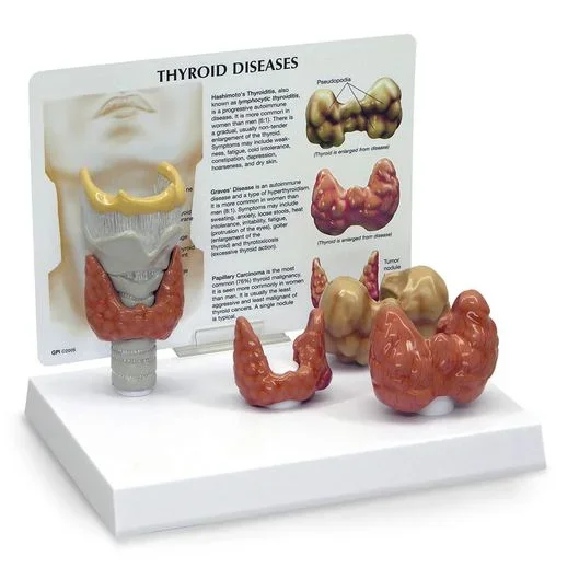 Nasco Nasco Thyroid Model – SB46541