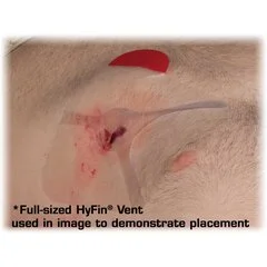 North American Rescue Chest Wound Seal Hyfin Vent Compact 4-3/4 X 4-3/4 Inch 2 per Pack NonSterile, 2 EA/PK - Image 2