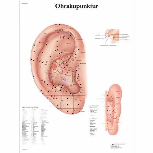 Ohrakupunktur – 4006650