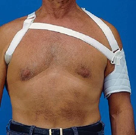 Patterson Medical Supply Rolyan Hemi Arm Sling Elastc Straps X-Large, Left, 28 – 34 Inch Acromion / Chest – A6539