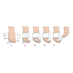 Pedifix Bunion Splint Softsplint™ Medium Left Foot, 1/EA - Image 2