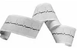 Print Media ECG / EEG Recording Paper Thermal 50 mm X 100 Foot Roll Without Grid – 3579426