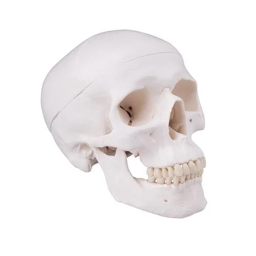 Skull with drill hole – 1020656