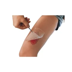 Smith & Nephew Impregnated Dressing Cuticerin 3 X 3 Inch Gauze Cuticerin - Image 2