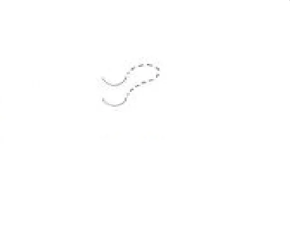 Surgical Specialties Surgical Specialties Suture with Needle Nonabsorbable Uncoated Black Suture Monofilament Nylon Size 10-0 12 Inch Suture Double-Armed 5.51 mm Length 1/2 Circle Ultraglide Needle – A9000N