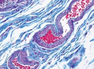 Trichrome stain (Gomori) Leica