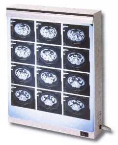 Wolf X-Ray Econoline Illuminator, Standard 14″ x 17″